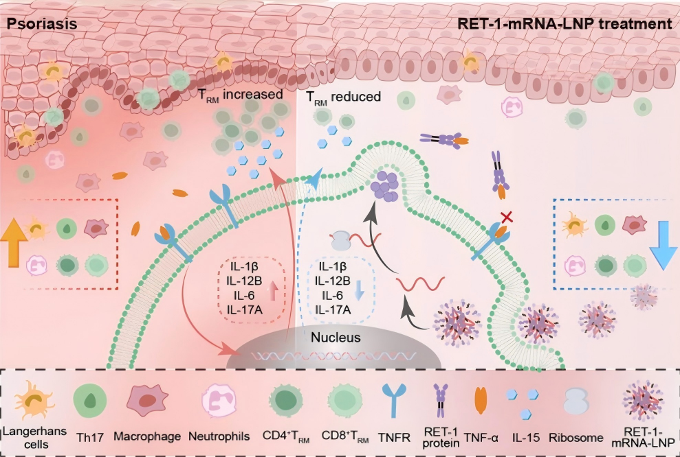 团队联合发表新型银屑病mRNA疗法